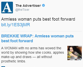 armless-woman