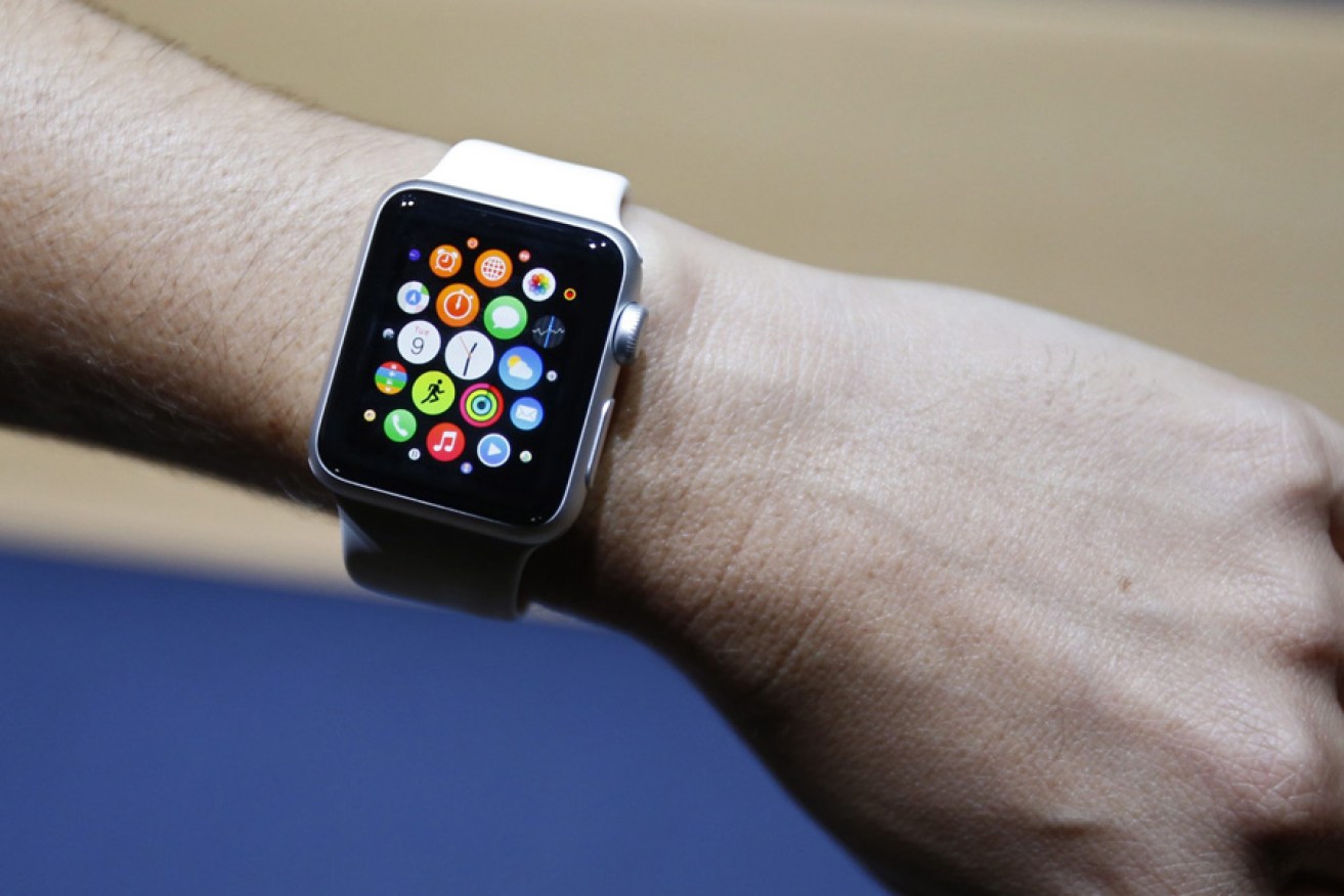 An Apple smartwatch