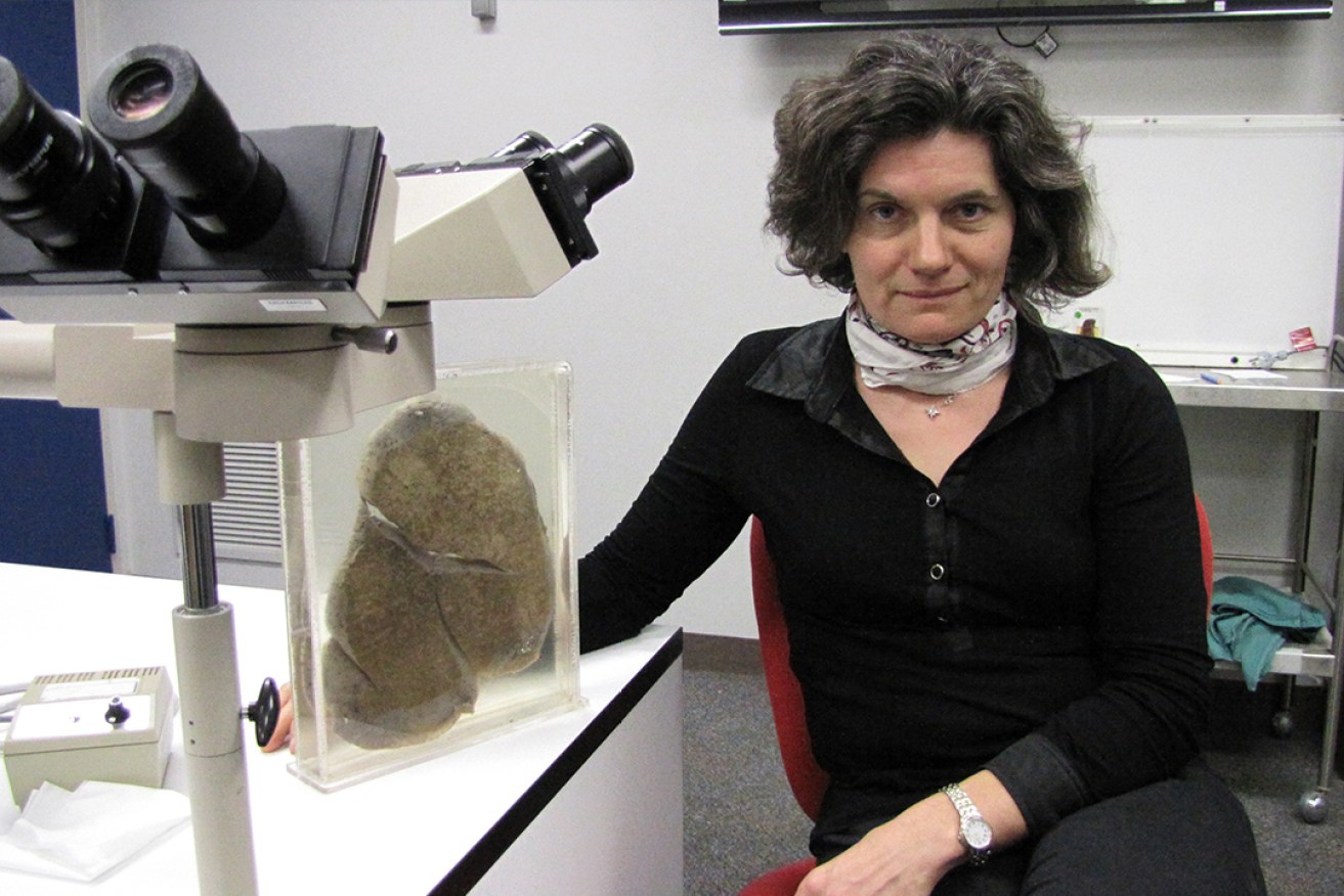 Oncology researcher Associate Professor Sonja Klebe in the pathology laboratory at Flinders University’s School of Medicine. Body 
