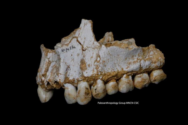 A dental calculus deposit is visible on the rear molar (right) of this upper jaw specimen found at El Sidron. This individual was eating poplar, a source of aspirin, and had also consumed moulded vegetation including Penicillium fungus, source of a natural antibiotic. Photo: Paleoanthropology Group MNCN-CSIC