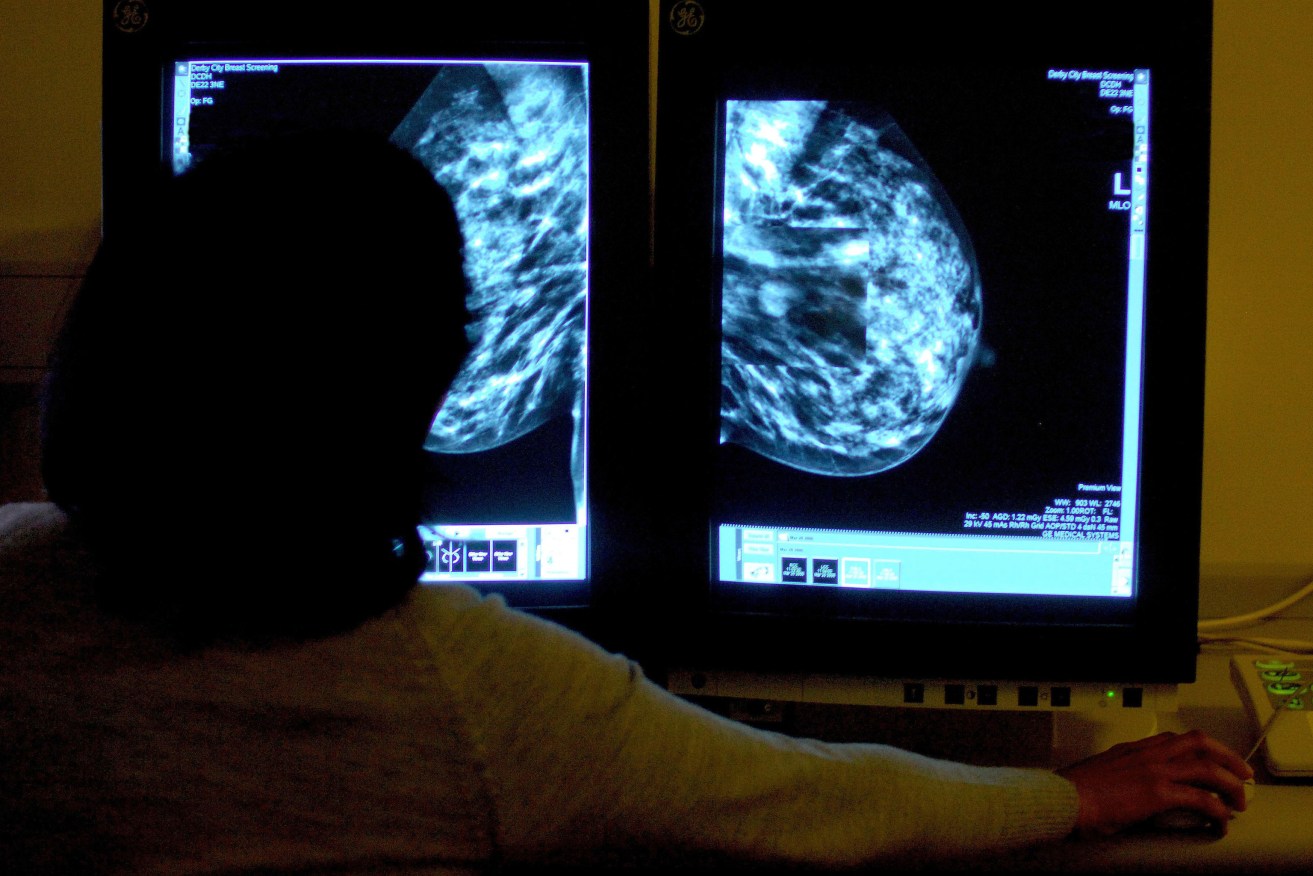 A a consultant studying a mammogram. Some cancers - such as breast and prostate cancer - affect wealthier Australians at higher rates. Photo: Rui Vieira/PA Wire