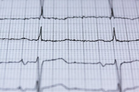Early menopause linked to heart disease risk