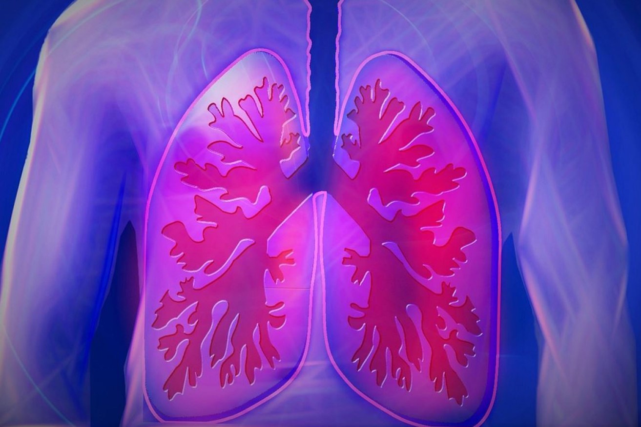 Mesothelioma’s long latency period can sometimes be decades after initial asbestos exposure. Stock image: Pixabay