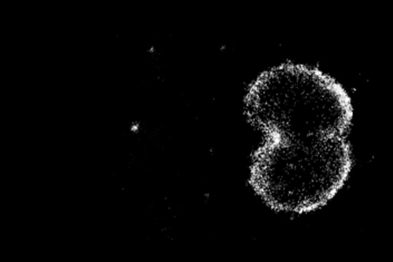  Gonorrhoea-causing bacteria and their vesicles interacting with immune cells, captured by a microscope. Australian scientists have Photo: AAP/ Monash University Biomedicine Discovery Institute